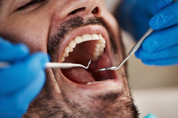 Best Teeth Whitening  in Mechanicsburg, OH
