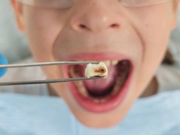 Best Dentist for Dental Trauma  in Mechanicsburg, OH